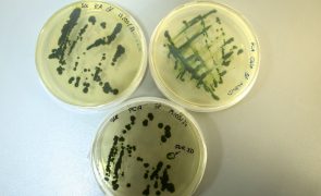 Cientistas de Coimbra criam produtos à base de algas contra vírus da covid-19