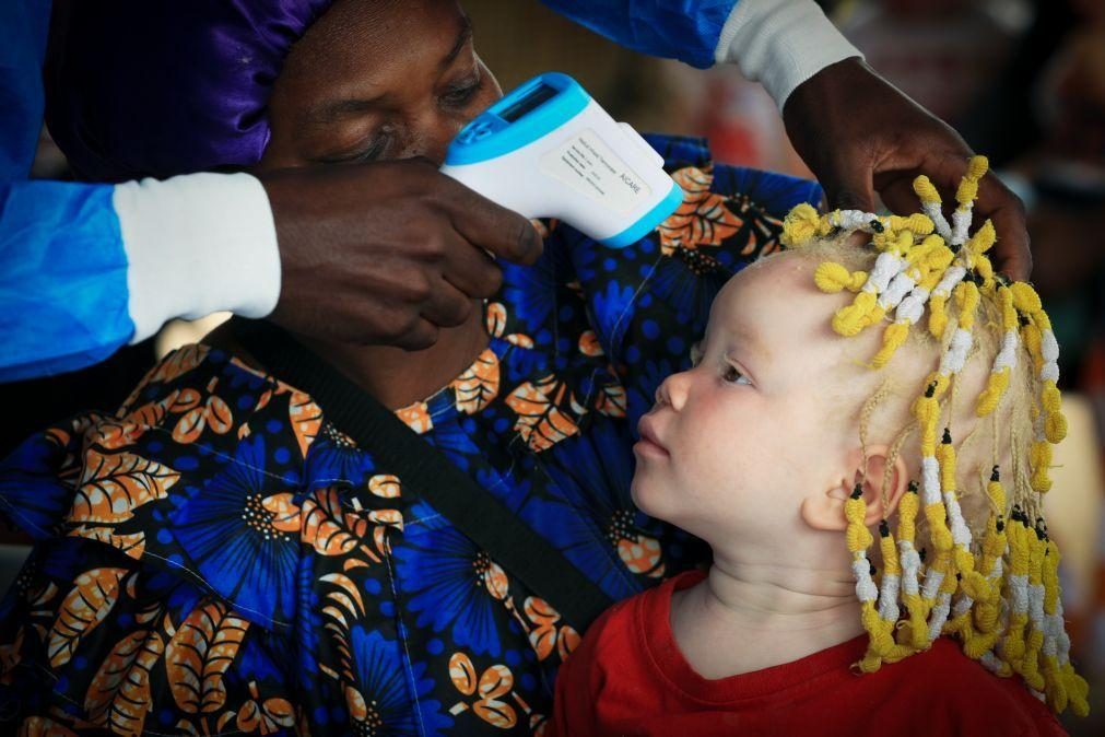 Médicos angolanos levam conforto a centenas de albinos no Bié